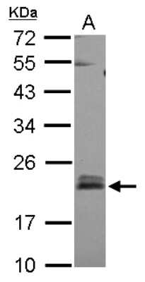 Western Blot: RhoB Antibody [NBP2-20154]