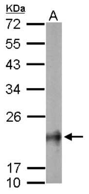 Western Blot: RhoB Antibody [NBP2-20154]