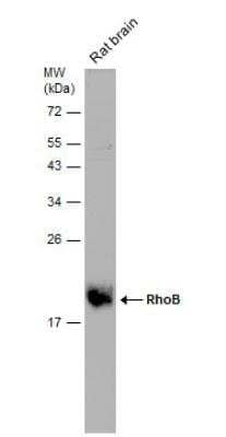 Western Blot: RhoB Antibody [NBP2-20154]