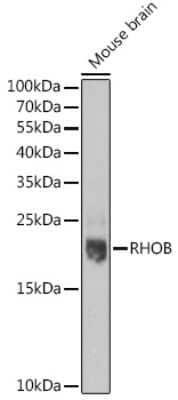 Western Blot: RhoB AntibodyBSA Free [NBP2-93526]