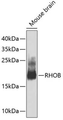 Western Blot: RhoB AntibodyAzide and BSA Free [NBP2-94104]