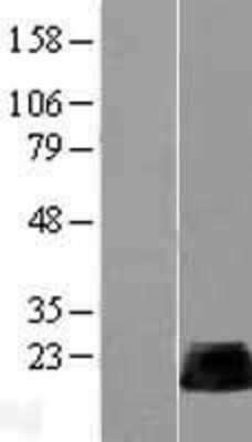 Western Blot: RhoB Overexpression Lysate [NBL1-15350]