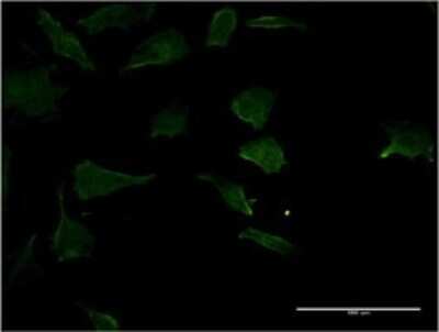 Immunocytochemistry/ Immunofluorescence: RhoC Antibody (1B7) [H00000389-M06]
