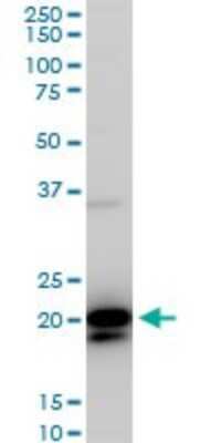Western Blot: RhoC Antibody (1B7) [H00000389-M06]
