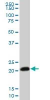 Western Blot: RhoC Antibody (1B7) [H00000389-M06]