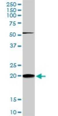 Western Blot: RhoC Antibody (2E12) [H00000389-M01]