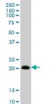 Western Blot: RhoC Antibody (2E12) [H00000389-M01]