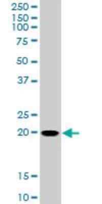 Western Blot: RhoC Antibody (2E12) [H00000389-M01]