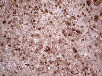 Immunohistochemistry: RhoC Antibody (OTI3A5) [NBP2-45574]