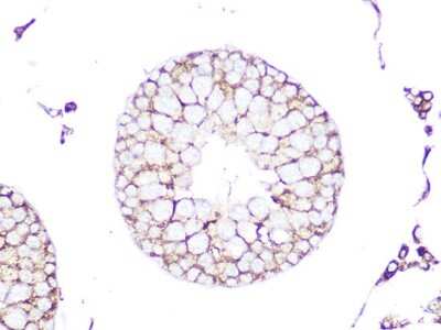 Immunohistochemistry-Paraffin: RhoC Antibody (7X5I9) [NBP3-16333]