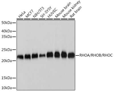 Western Blot: RhoC Antibody (7X5I9) [NBP3-16333]