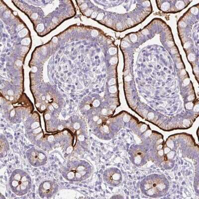 Immunohistochemistry: RhoC Antibody [NBP2-38651]