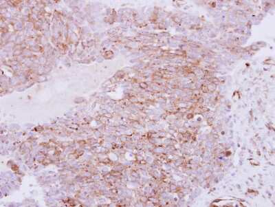 Immunohistochemistry-Paraffin: RhoC Antibody [NBP2-20156]