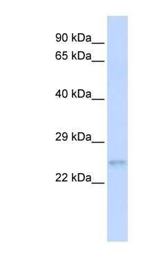 Western Blot: RhoC Antibody [NBP1-58351]