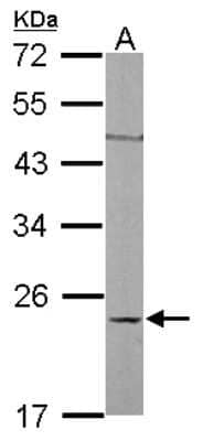 Western Blot: RhoC Antibody [NBP2-20156]