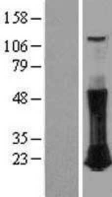 Western Blot: RhoC Overexpression Lysate [NBL1-15354]