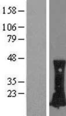 Western Blot: RhoC Overexpression Lysate [NBL1-15355]