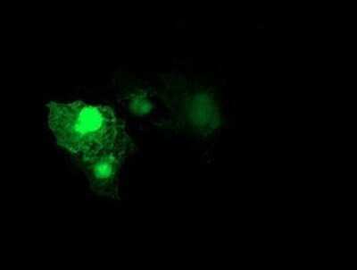 Immunocytochemistry/ Immunofluorescence: RhoD Antibody (OTI2F7) - Azide and BSA Free [NBP2-73889]
