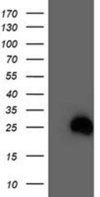 Western Blot: RhoD Antibody (OTI2F7)Azide and BSA Free [NBP2-73889]