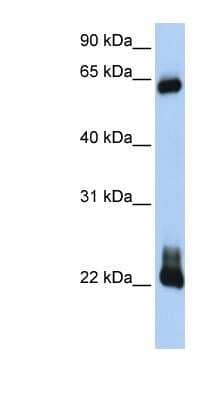 Western Blot: RhoD Antibody [NBP1-58359]