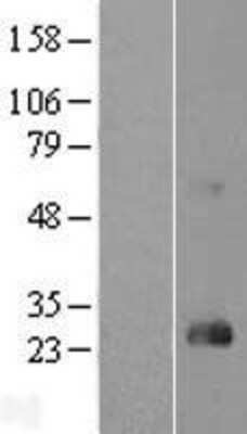 Western Blot: RhoD Overexpression Lysate [NBL1-15356]