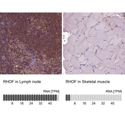 Immunohistochemistry-Paraffin: RhoF Antibody [NBP2-62699]