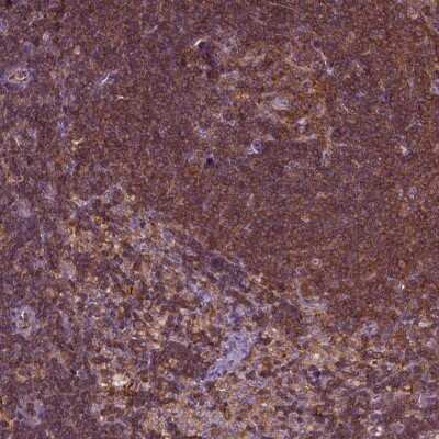 Immunohistochemistry-Paraffin: RhoF Antibody [NBP2-62699]