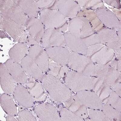 Immunohistochemistry-Paraffin: RhoF Antibody [NBP2-62699]