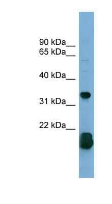 Western Blot: RhoF Antibody [NBP1-55116]