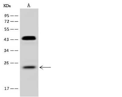 Western Blot: RhoF Antibody [NBP2-98649]