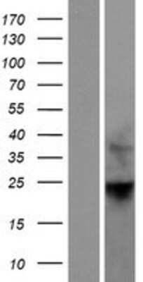 Western Blot: RhoF Overexpression Lysate [NBP2-06736]