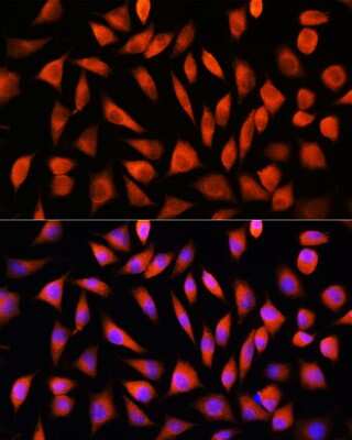 Immunocytochemistry/ Immunofluorescence: RhoG Antibody - Azide and BSA Free [NBP3-15747]