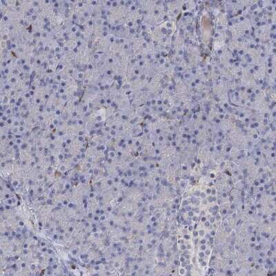 Immunohistochemistry-Paraffin: RhoG Antibody [NBP1-88832]