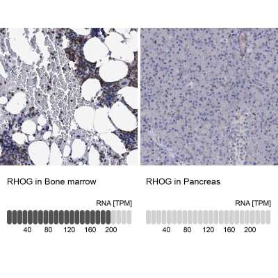 Immunohistochemistry-Paraffin: RhoG Antibody [NBP1-88832]