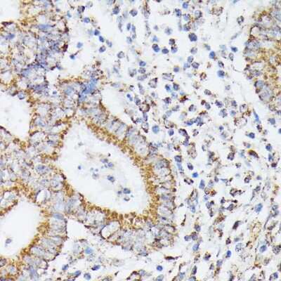 Immunohistochemistry-Paraffin: RhoG Antibody - Azide and BSA Free [NBP3-15747]