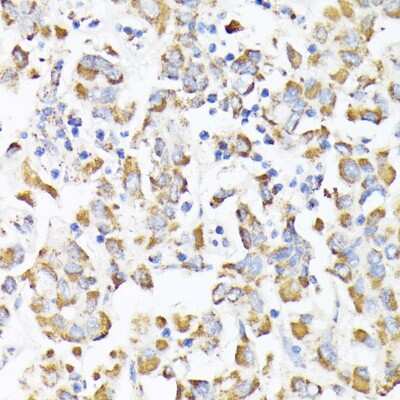 Immunohistochemistry-Paraffin: RhoG Antibody - Azide and BSA Free [NBP3-15747]