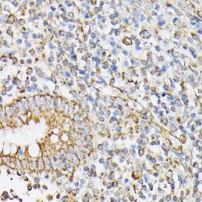Immunohistochemistry-Paraffin: RhoG Antibody - Azide and BSA Free [NBP3-15747]