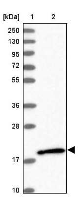 Western Blot: RhoG Antibody [NBP1-88832]