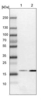 Western Blot: RhoG Antibody [NBP1-88832]