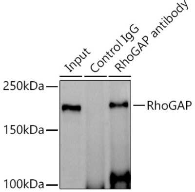 Immunoprecipitation: RhoGAP Antibody (3L9I3) [NBP3-16114]