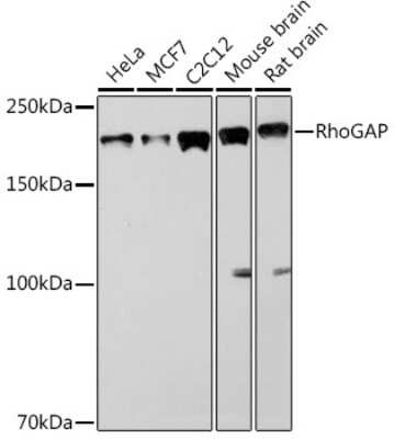 Western Blot: RhoGAP Antibody (3L9I3) [NBP3-16114]