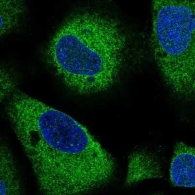 Immunocytochemistry/ Immunofluorescence: RhoGAP Antibody [NBP2-58620]