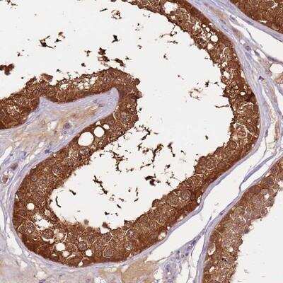 Immunohistochemistry-Paraffin: RhoGAP Antibody [NBP2-14308]