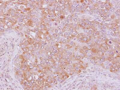 Immunohistochemistry-Paraffin: RhoGAP Antibody [NBP2-20158]