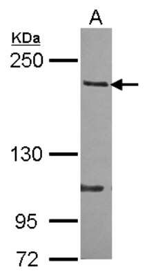 Western Blot: RhoGAP Antibody [NBP2-20158]