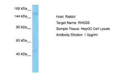 Western Blot: RhoGAP Antibody [NBP2-88152]