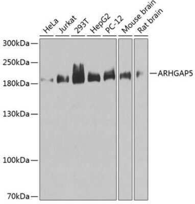 Western Blot: RhoGAP AntibodyBSA Free [NBP2-94863]