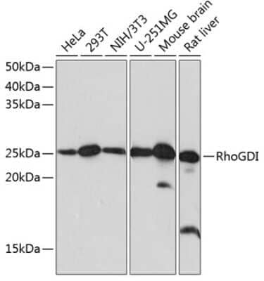 Western Blot: RhoGDI Antibody (0D6X5) [NBP3-15401]