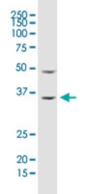 Western Blot: RhoGDI Antibody (1G5-2F3) [H00000396-M02]