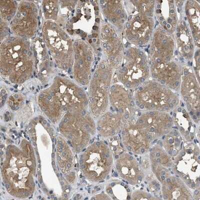 Immunohistochemistry-Paraffin: RhoGDI Antibody [NBP1-92333]